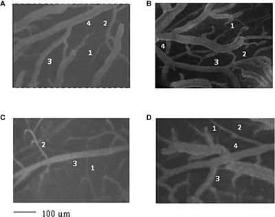 Geometric Features of the Pial Arteriolar Networks in Spontaneous Hypertensive Rats: A Crucial Aspect Underlying the Blood Flow Regulation